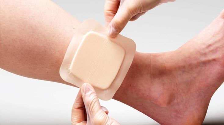 Iodine solution, alcohol, hydrogen peroxide—that bottle of disinfectant at home might be damaging the wound.